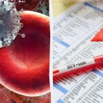 Descoperire în căutarea unui remediu pentru HIV: oamenii de știință